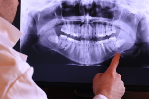 Best Emergency Tooth Extraction in Maplewood, MO